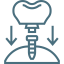 dental-implant dental-implant